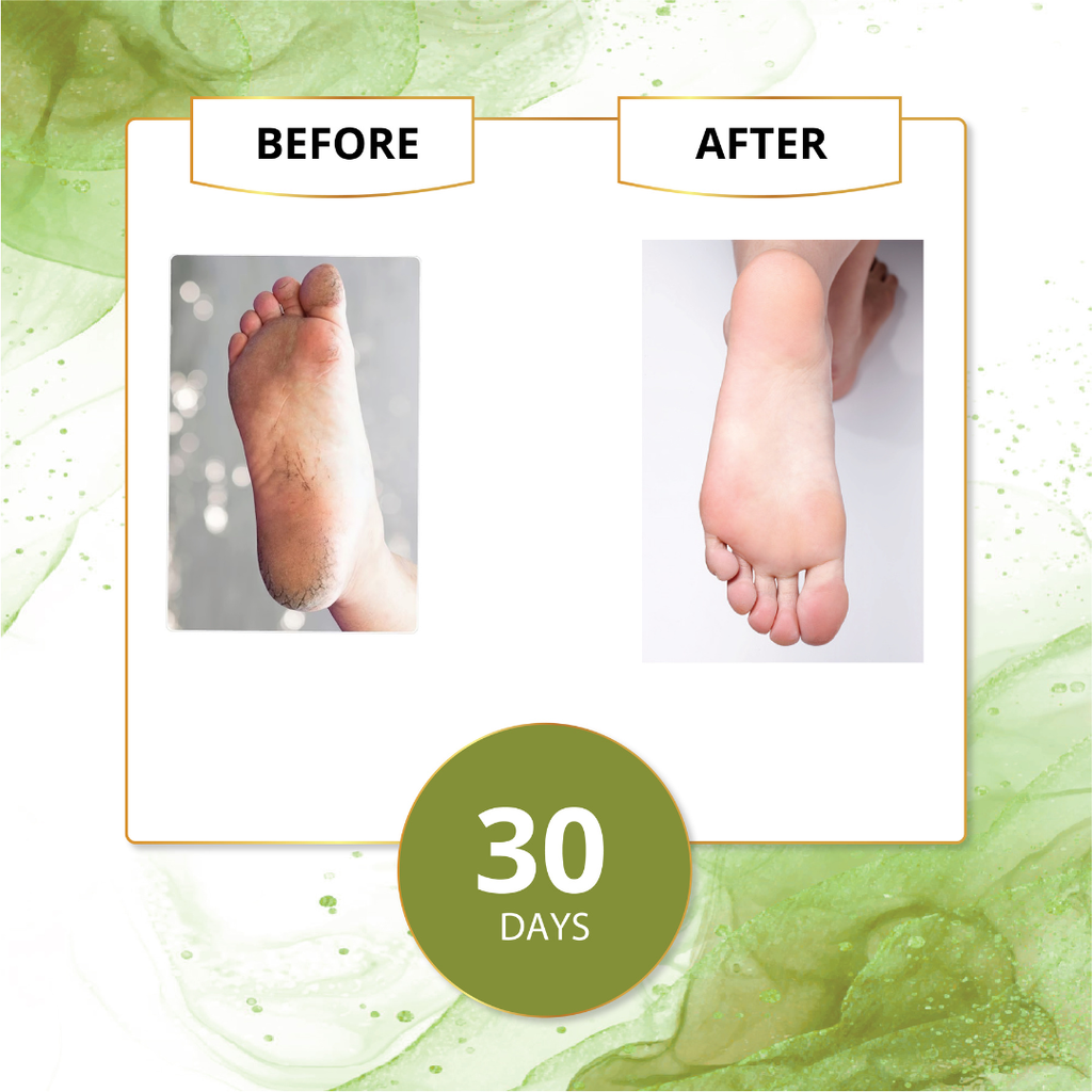 Footcare Cream