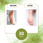 Footcare Cream