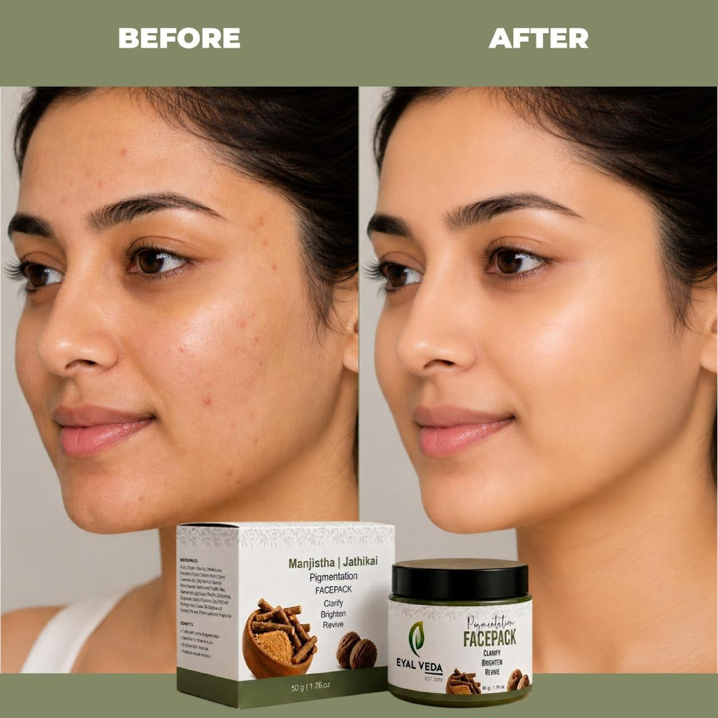 Manjistha/jathikai Pigmatation facepack