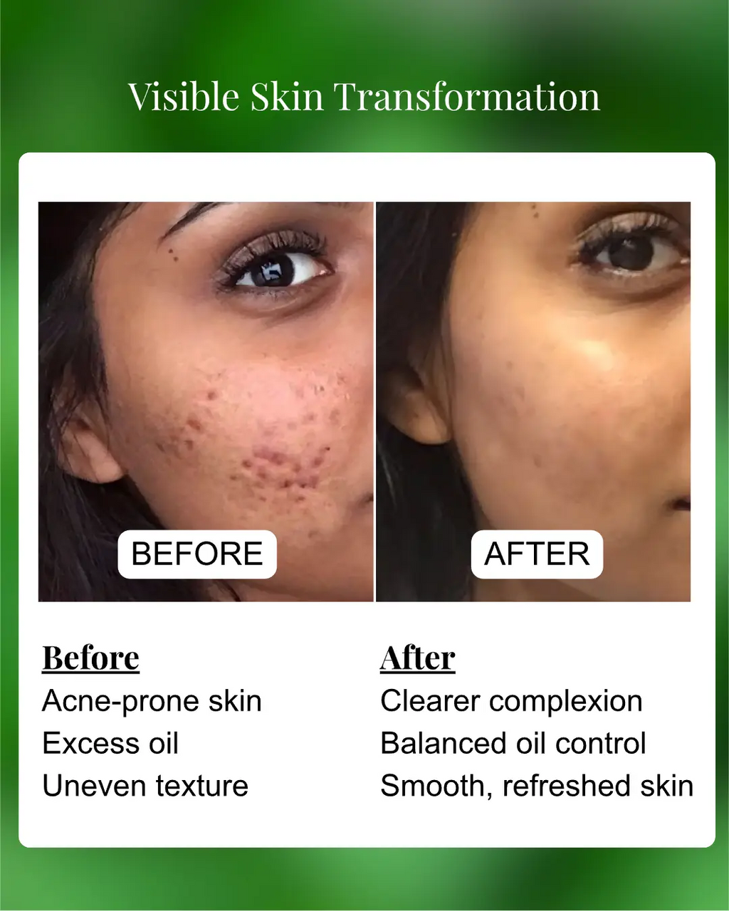 Before and after comparison of skin transformation with text describing improvements.