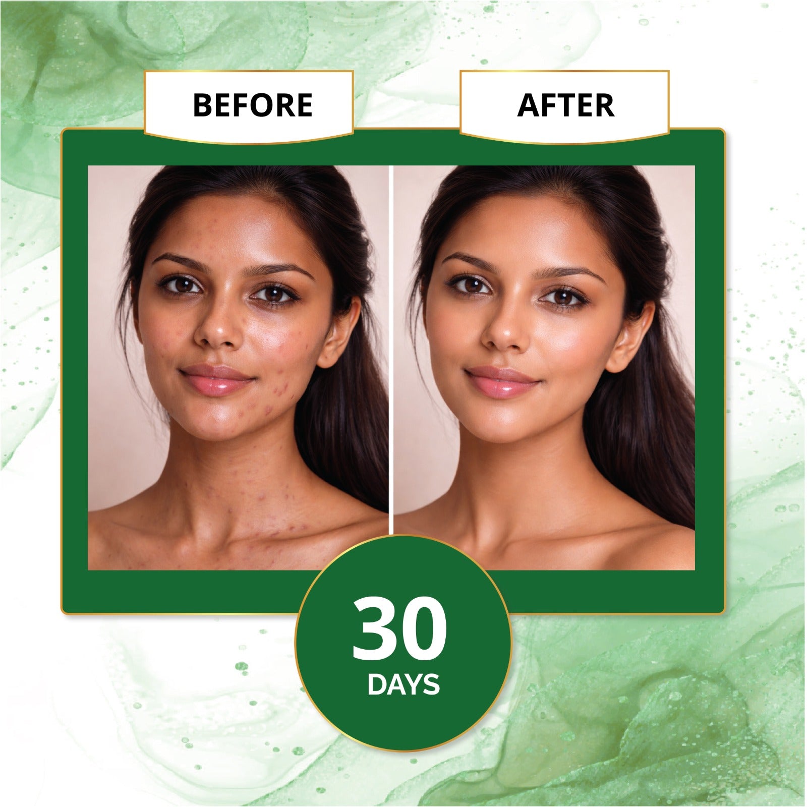 Natural Kuppaimeni Face Pack Powder for Clear Skin & Pimples – EYAL VEDA