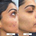 Aloe Vera Gel visible skin improvement before and after results