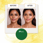 Real skin brightening and tan removal results after 30 days of using Avarampoo soap.