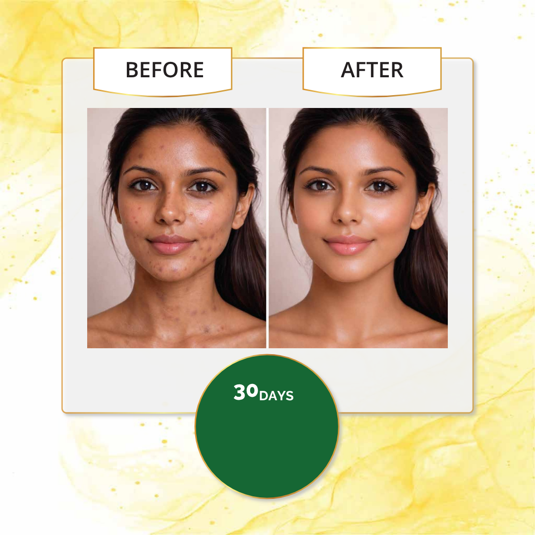 Real skin brightening and tan removal results after 30 days of using Avarampoo soap.