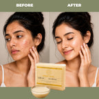 Before and after comparison of a woman's face with Kadhhi Eyal goat milk soap.