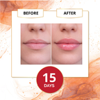 before after results of lip balm for dark lips improvement