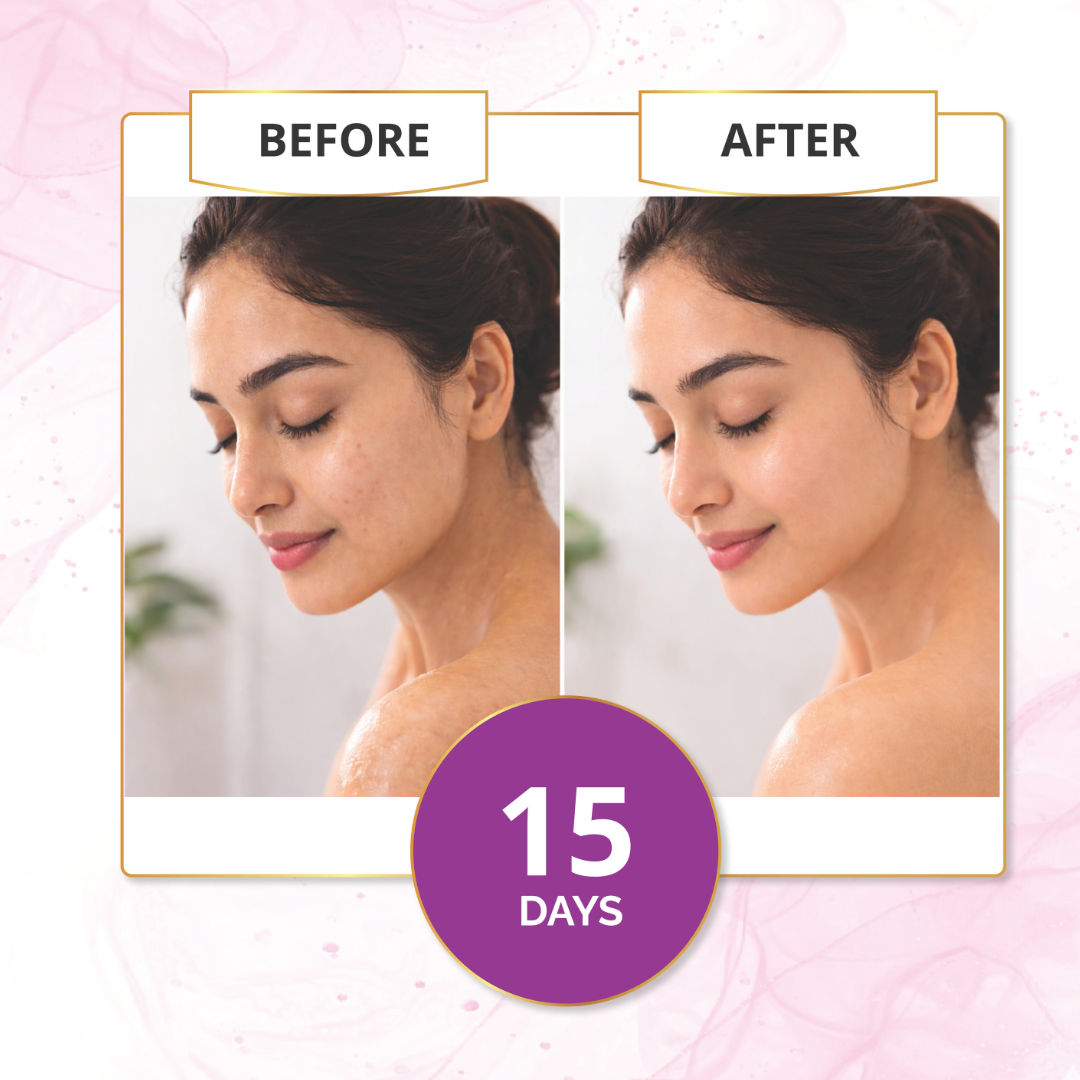 Before and after using rose water toner showing improved skin glow